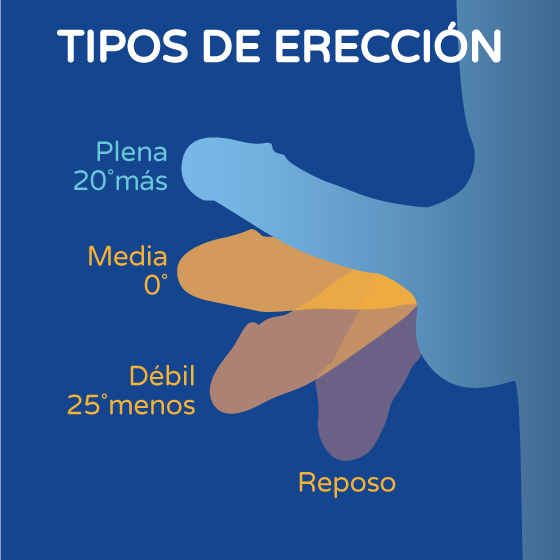 Tipos de erección gráfico Boston Medical Group España