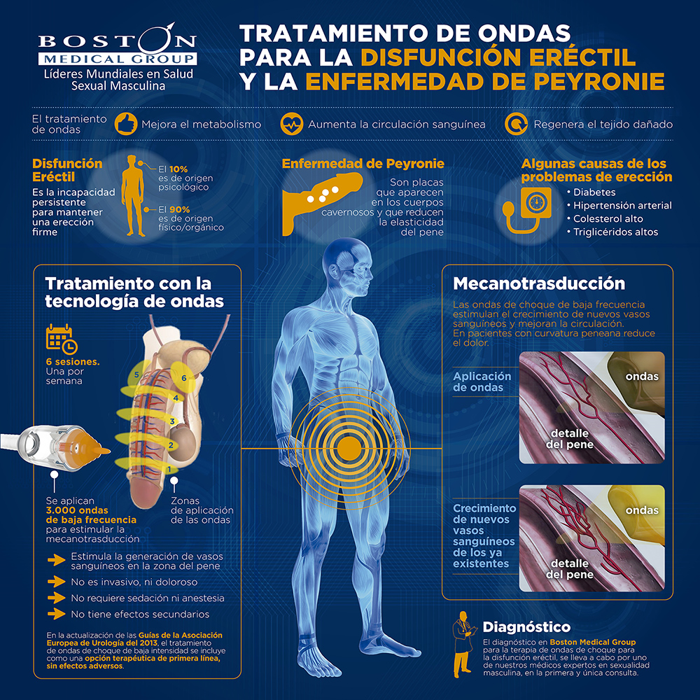 infografia-tratamiento-de-ondas-para-la-disfunción-eréctil